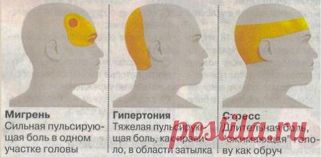 "Голова болит" - по-научному..