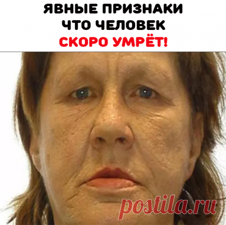 Врач-реаниматолог Артем Луговой рассказал , какие признаки указывают на приближение смерти человека:  «Если цвет кожи меняется — пациент посинел или посерел — это признак неблагоприятного исхода. Появление мраморности на коже  также свидетельствует о нарушении микроциркуляции и насыщения крови кислородом», — отметил медик.

По его словам, в список опасных признаков входят «холодный пот, липкий кожный покров, а также посинение губ и кончиков пальцев Расширение зрачков тоже перед смертью.