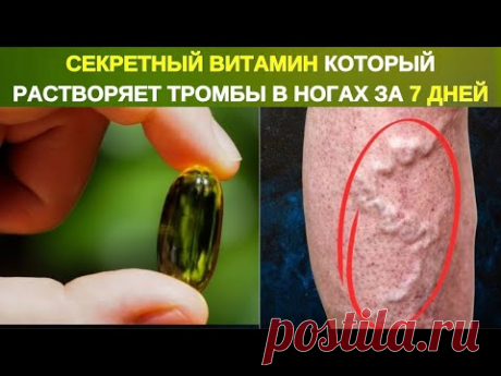 💊🚨 СЕКРЕТНЫЙ ВИТАМИН, РАСТВОРЯЮЩИЙ КРОВЯНЫЕ СГУСТКИ В ВАШИХ НОГАХ 🦵💥