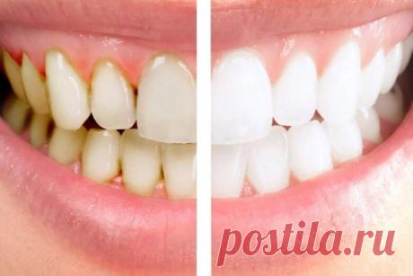 Зубной камень можно удалить в домашних условиях | Новости дня | Дзен