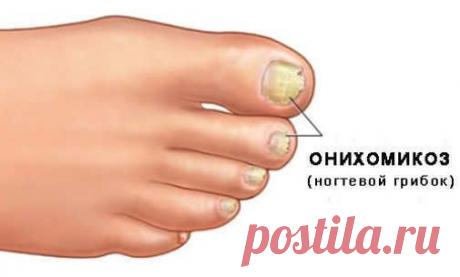 Советы и рецепты для Вашего здоровья