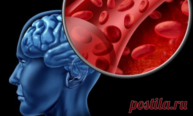 Улучшение мозгового кровообращения: народные средства Улучшение мозгового кровообращения - это отличная профилактика сосудистых заболеваний и снижение риска инсульта. Пять рецептов и комплекс лечебной гимнастики.


Улучшение мозгового кровообращения - эт…