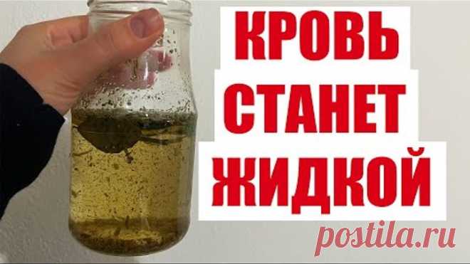 ПЬЮ И ОЖИВАЮ! ГУСТУЮ КРОВЬ ДЕЛАЕТ ЖИДКОЙ! ВЫВОДИТ МОКРОТУ, СНИЖАЕТ ДАВЛЕНИЕ, РАСТВОРЯЕТ БЛЯШКИ