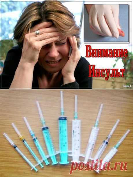 Помощь при инсульте — кровопускание