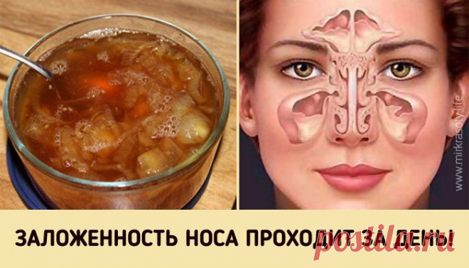 Супер-средство от заложенного носа