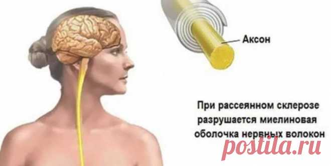 Народные средства для улучшения мозгового кровообращения: скажи «нет» слабоумию, рассеянности и немощи