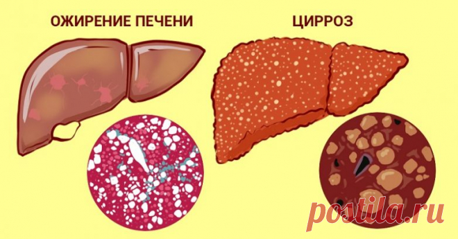 5 народных рецептов из трав для печени