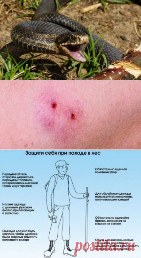 Первая помощь при укусе гадюки — Делимся советами