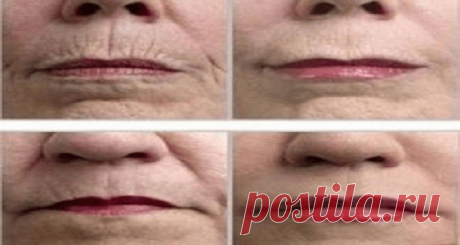 Просто протрите свою кожу этой специей, и морщины исчезнут!