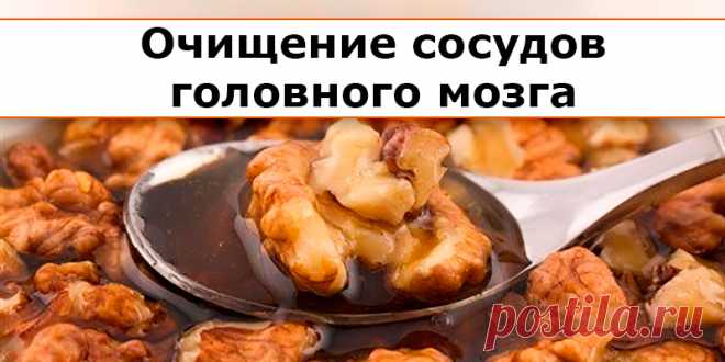 Очищение сосудов головного мозга | Полезные советы