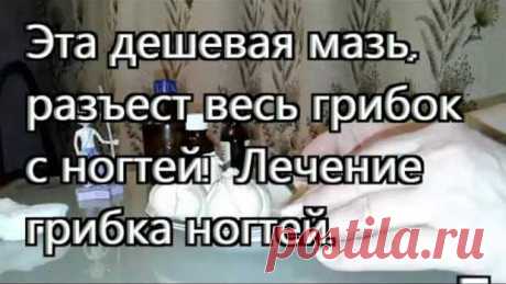 Эта дешевая мазь # разъест весь грибок с ногтей! Лечение грибка ногтей. 🎇🎇🎇.