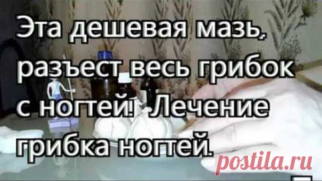 Эта дешевая мазь # разъест весь грибок с ногтей! Лечение грибка ногтей. 🎇🎇🎇.