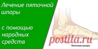 Лечение пяточной шпоры с помощью народных средств | Полезные советы