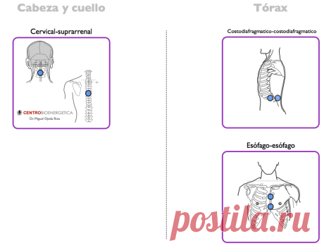 biomagnetismo puntos de rastreo - Buscar con Google