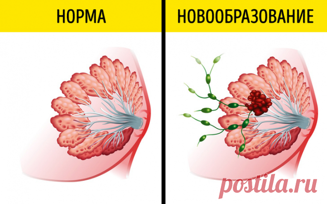 Как часто нужно обращаться к врачу, чтобы ловить болезни на ранних стадиях