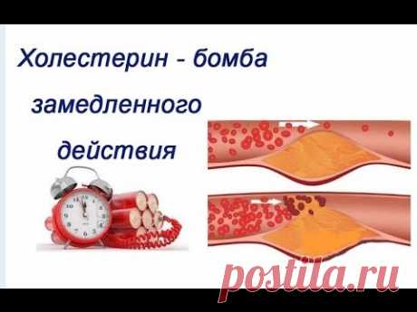 Холестерин - бомба замедленного действия!