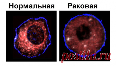 Рак – это общее название для обширной группы онкологических заболеваний, при которых клетки тела начинают бесконтрольный рост и деление .Все типы рака начинаются, когда клетки тела начинают расти бесконтрольно. Вместо того, чтобы умереть, раковые клетки продолжают расти и размножаться. У клеток рака, в отличие от нормальных клеток, существует способность вторгаться в другие ткани, постепенно увеличивая размеры опухоли.