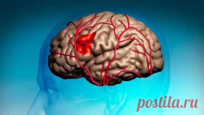 Как простая игла может спасти вам жизнь в случае инсульта? / Будьте здоровы