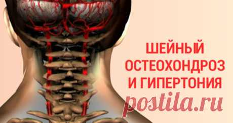 90% трудоспособного населения страдает от шейного остеохондроза… Останови этот замкнутый круг!