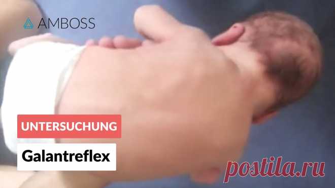 Galantreflex - Frühkindliche Reflexe - AMBOSS Video AMBOSS, Wissen – von Medizinern für Mediziner. https://www.amboss.com/de Im Rahmen der Kindervorsorgeuntersuchungen U2 und U3 werden standardmäßig auch die N...