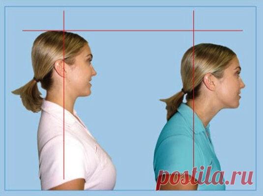 Грыжи в шейном отделе позвоночника, кифоз: как жить дальше | Хочу жить долго | Яндекс Дзен