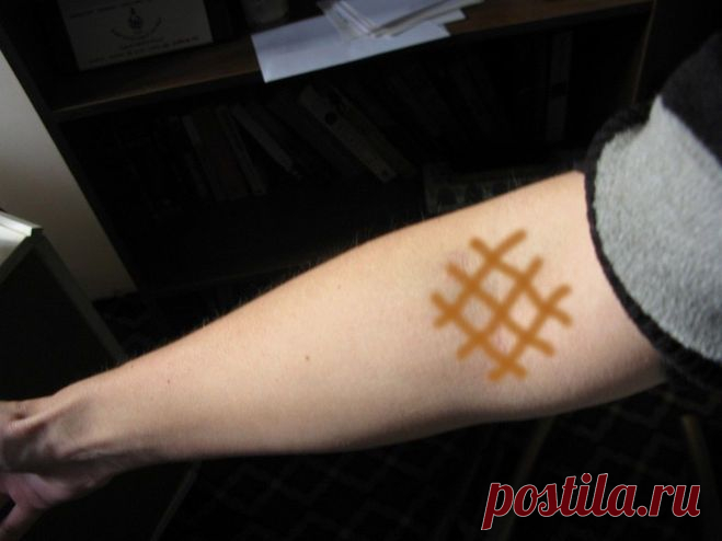 Разные способы применения йода — Всегда в форме!