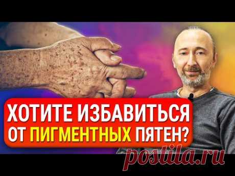 Как избавиться от пигментных ПЯТЕН на лице и теле? Причины появления. Старческие пигментные пятна.
