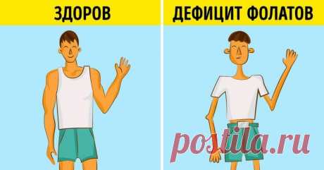 Признаки недостатка фолиевой кислоты в организме — Бабушкины секреты