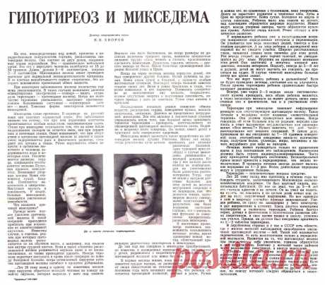 Гипотиреоз и микседема