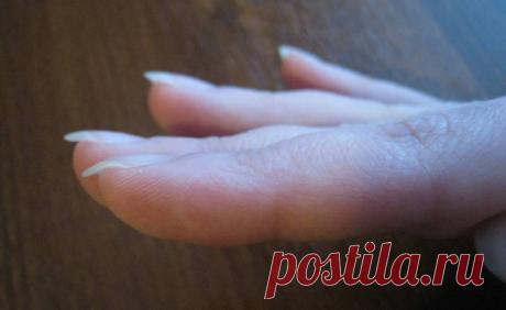 Почему загибаются ногти на руках (вниз и вверх) ФОТО