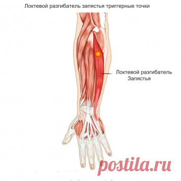 Локтевой разгибатель запястья. Самомассаж