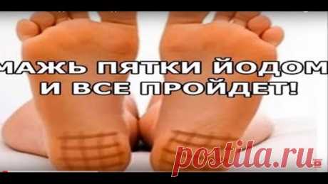 Мажьте ПЯТКИ ЙОДОМ и всё ПРОЙДЁТ.