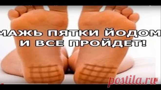 Мажьте ПЯТКИ ЙОДОМ и всё ПРОЙДЁТ.