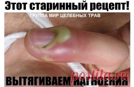 Этот старинный рецепт вытягивает нагноения!
 Вытягивает всю гадость на ура.
Итак, сам рецепт: 
1 ч. л. меда 
1 ст. л. муки 
1 сырой желток 
Перемешиваем и храним в холодильнике. Накладываем на нужное место, сверху укрываем туалетной бумагой. Меняем повязку каждые 3 часа. Ночью можно не менять. Буквально следующий день без всякой боли начинает выходить гной.
Если ранка болезненная, то просто снимаем бумагу, специально ничего не подчищая накладываем новый слой