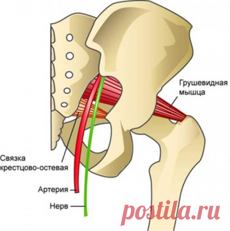 Синдром грушевидной мышцы: 10 упражнений