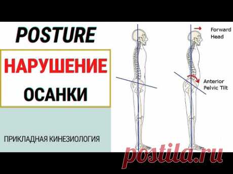 ВИЗУАЛЬНАЯ ДИАГНОСТИКА. СРАВНЕНИЕ ЛОКАЛИЗАЦИИ БОЛИ И ЕЕ ПРИЧИНЫ. ПРИКЛАДНАЯ КИНЕЗИОЛОГИЯ.