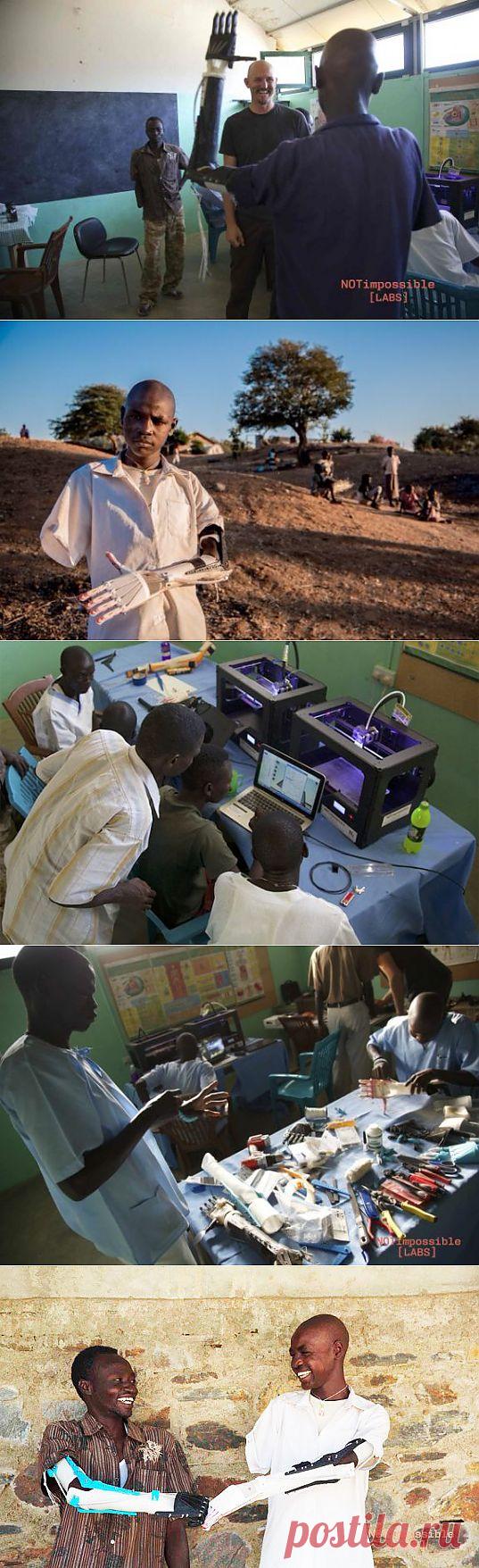 Проект Даниэль: 3D-протезы дарят надежду пострадавшим в Судане