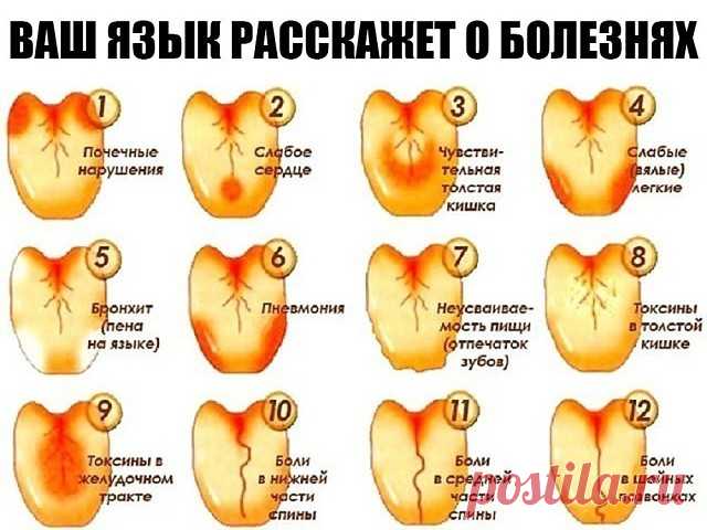 ВАШ ЯЗЫК РАССКАЖЕТ О БОЛЕЗНЯХ

Язык, помимо прочих важных функций, служит зеркалом организма – по нему можно определить и состояние иммунитета, и диабет, и проблемы с почками…

Считается, что чистый язык, без налета - признак здоровья пищеварительной системы. Но здесь все не так просто. Язык способен отражать состояние практически всех органов и систем. Например, кончик языка отвечает за тазовые органы, середина слева - за печень, а справа - за селезенку. Боковые края пока...