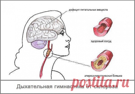 (86) Одноклассники