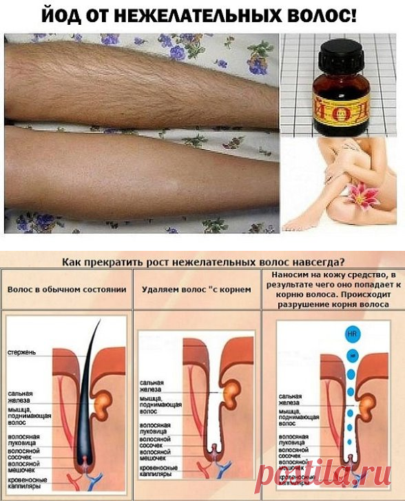Нежелательные волосы