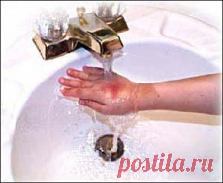 Лечим ожог без докторов... | Познавательный сайт ,,1000 мелочей"