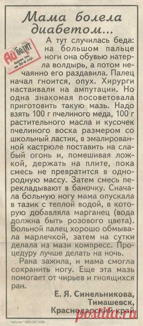 Мазь помогла избежать ампутации пальца на ноге при диабете