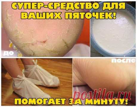 СУПЕР-СРЕДСТВО ДЛЯ ВАШИХ ПЯТОЧЕК! ПОМОГАЕТ ЗА МИНУТУ!