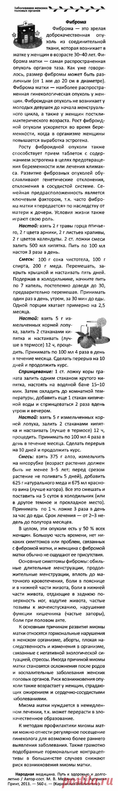 Фиброма