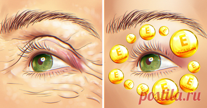 Домашний «ботокс» от морщин: 2 недели — и лицо как после подтяжки! Впитывается за считанные минуты.