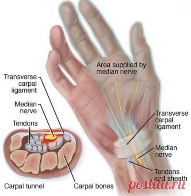 Симптомы, которые должны вас насторожить. Синдром запястного канала Есть мнение, что повторяющиеся, однотипные движения могут привести к синдрому запястного канала. Заболевание принято считать профессиональным у людей, осуществляющих монотонные сгибательно-разгибательные движения кисти. Это, например, сурдопереводчики, мотогонщики, велосипедисты, пианисты, киберспортсмены, барабанщики.