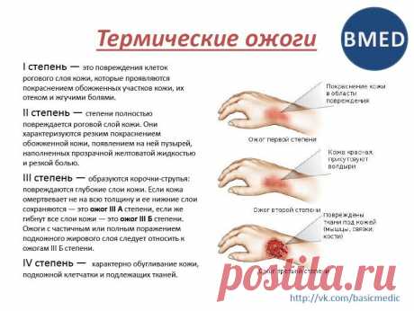 термические ожоги