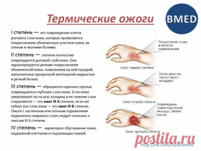 термические ожоги