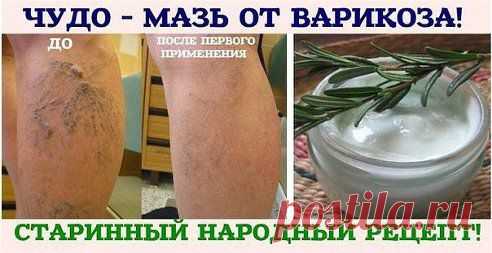 ЧУДО - МАЗЬ ОТ ВАРИКОЗА! 

Нет, но обязательно попробую
