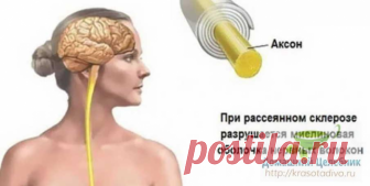 Народные средства для улучшения мозгового кровообращения: скажи «нет» слабоумию, рассеянности и немощи
